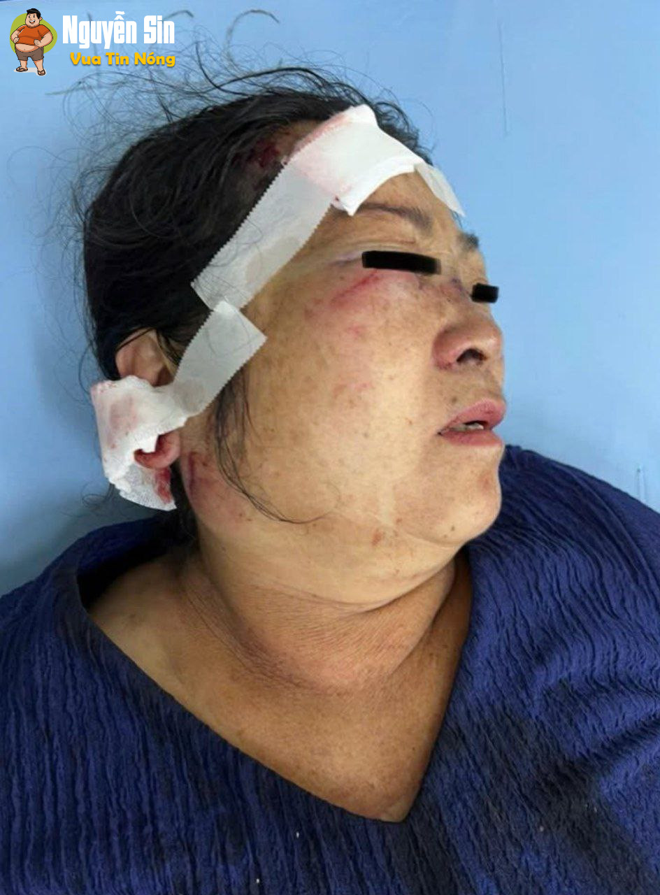 Lâm Đồng- Đà Lạt: 2 thanh niên chặn đ@nh bà già 60 năm cuộc đời
