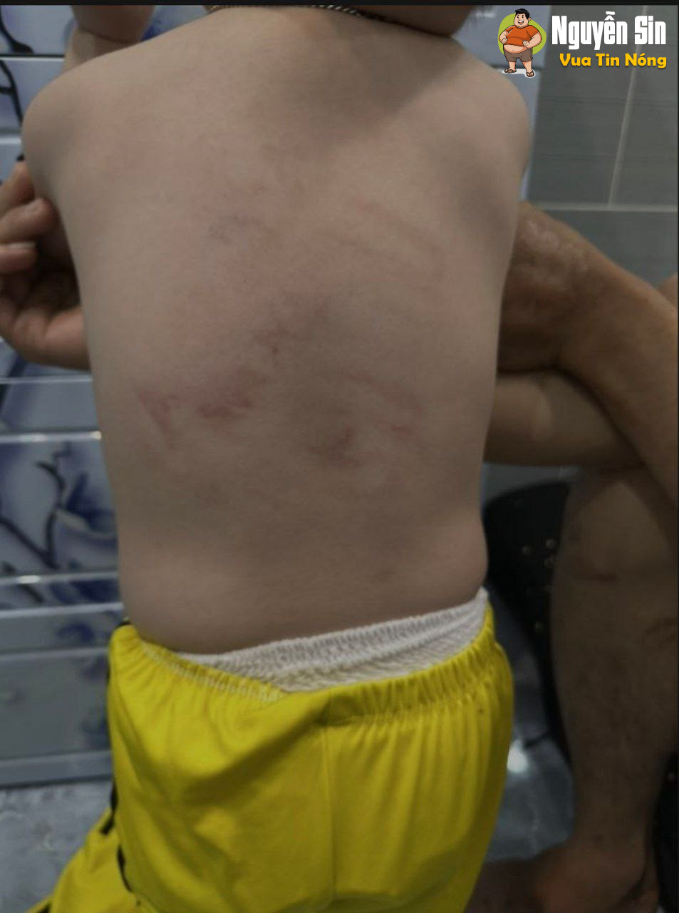 Ngã tư An Bình – Trảng Bàng – Tây Ninh: Xuất hiện bài viết tố cáo trường mầm non bạo hành