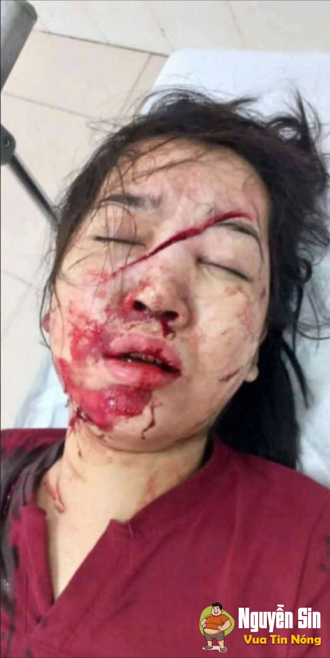 Hải Phòng: là không lòng vòng ah! FaceID với 1 đường chéo..