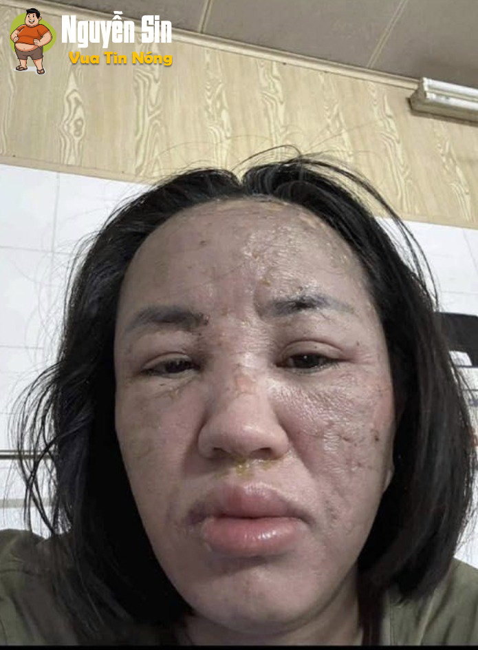 lỗi FaceID vì hứng nguyên nồi lẩu.. đồng đạo mà sao vậy nhỉ!