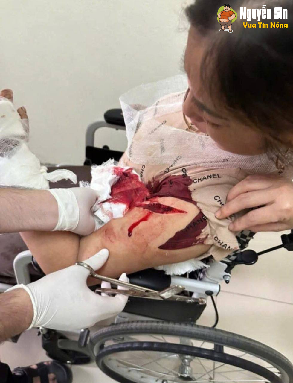 Cập nhật hình ảnh: Thanh Hóa – 1 bà rựa dài, 1 bà rựa ngắn thi đấu giáp lá cà