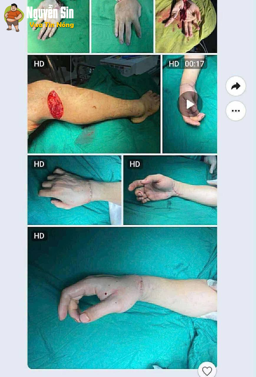 Ngoc Hà (Hà Lít) và những tình tiết có thể là nguồn cơn của việc “chia tay”