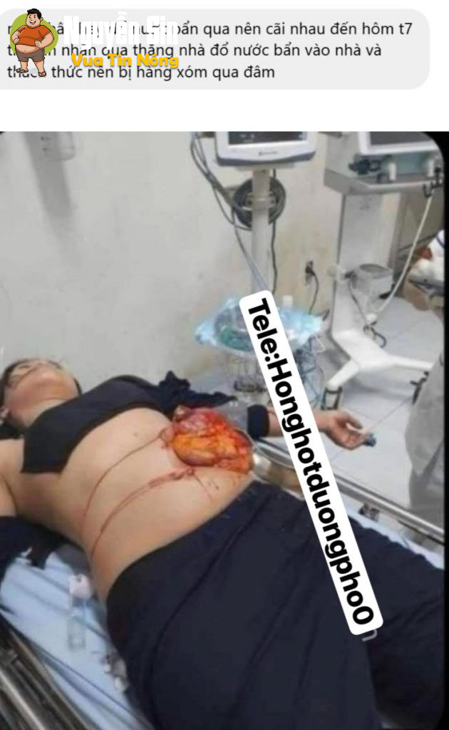 Quảng Nam: Mâu thuẫn hàng xóm, ng phụ nữ bị 🔪 lòi ruột