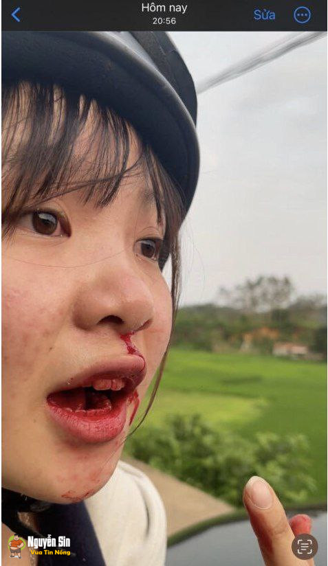 Bắc Giang: Cô gái bị tài xế ô tô hành hung đánh, đập khi cô đang trên đường đi học về.