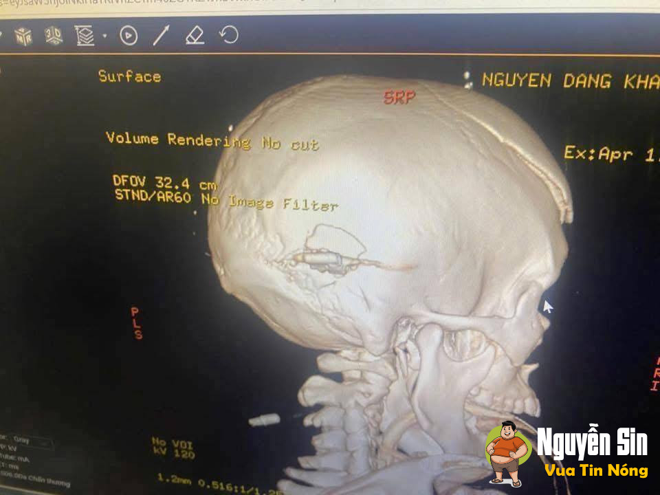 Thông tin thêm về vụ việc truy nã kẻ buôn ma túy nổ súng vào công an, đã có chiến sĩ hy sinh