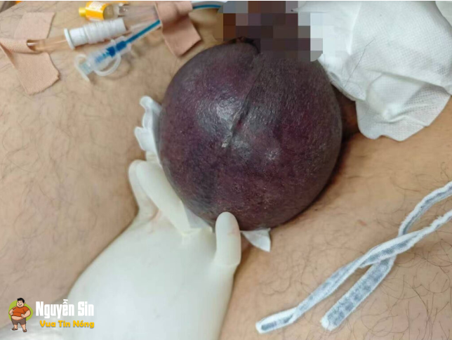 Va chạm giao thông khiến bộ phận sinh dục của người đàn ông bị…
