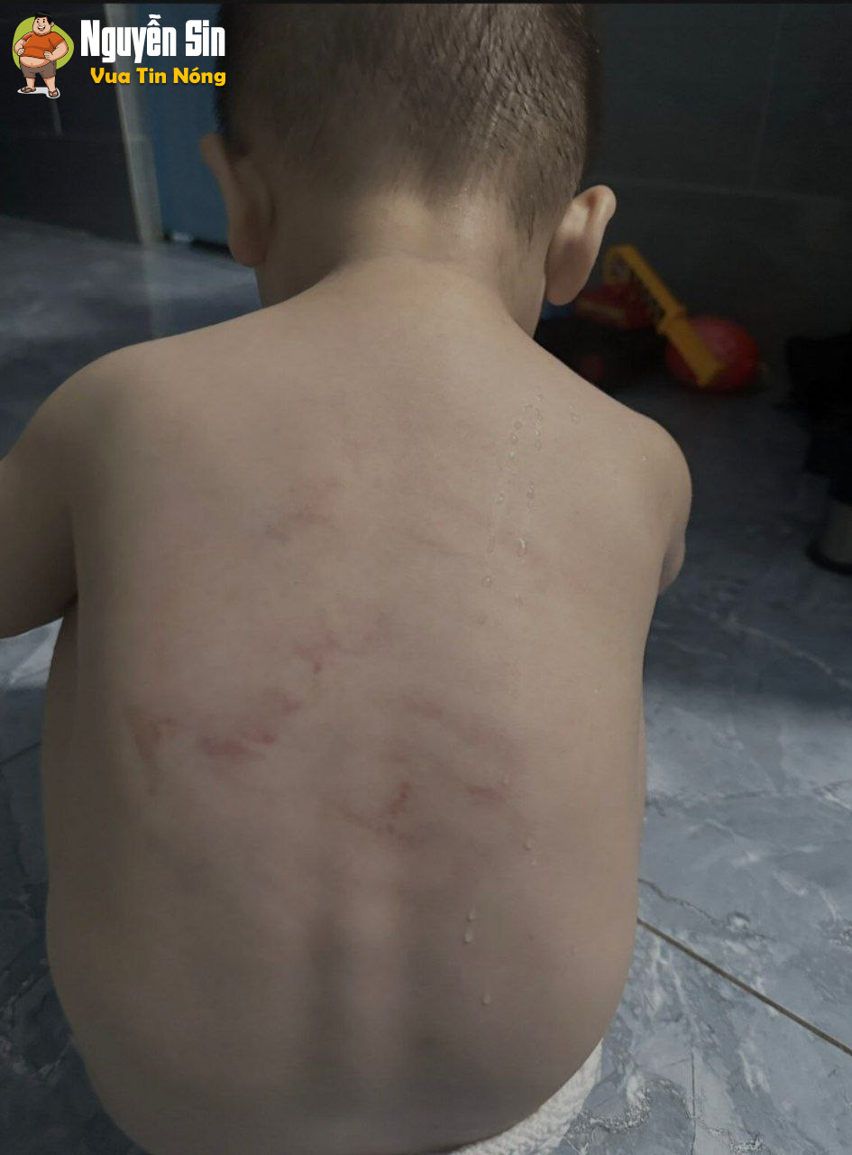 Ngã tư An Bình – Trảng Bàng – Tây Ninh: Xuất hiện bài viết tố cáo trường mầm non bạo hành