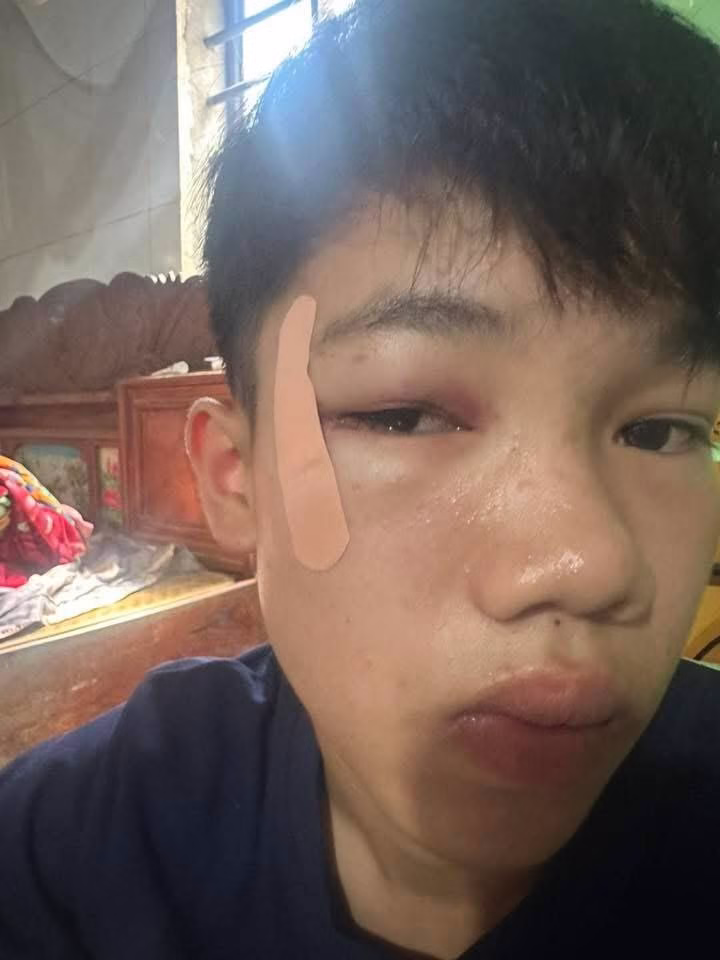 Quảng Bình: ông chú manh động phang các cháu trong quán bi-a, chưa rõ nguyên nhân là gì?