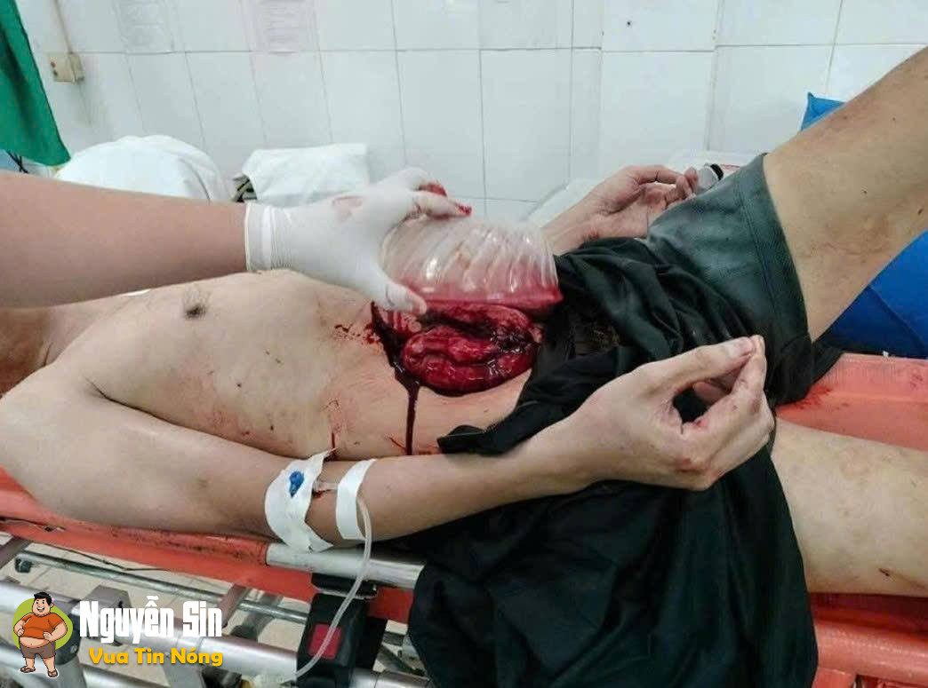 Bắc Ninh: vkck mâu thuẫn.. lòng không se điếu phải được hứng bằng tô 🙁 (