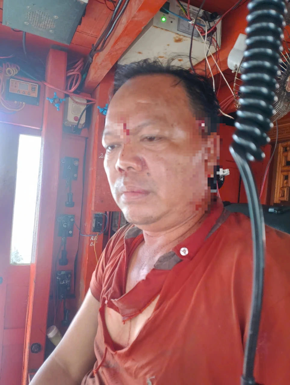 Thuyền trưởng bị nhiều người trên các tàu cá vây đánh, chém bị thương