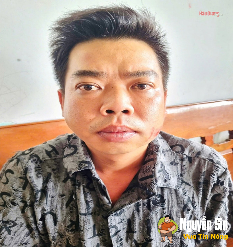 Hậu Giang: mâu thuẫn khi hát karaoke bài “Đất Phương Nam”, người đàn ông cho bạn nhậu thành “Dương Quá”