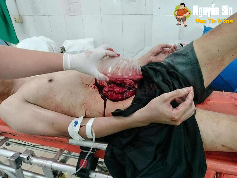 Lạc Thổ – Thuận Thành, Bắc Ninh trưa nay, thấy bảo là vợ chồng mauthuan