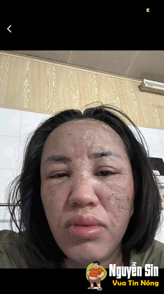 Gái xinh ăn nguyên nồi lẩu, đấy trên bàn rượu mãi là anh em với chân quý nhau. Cãi nhau phát lại tiên lượng xấu luôn