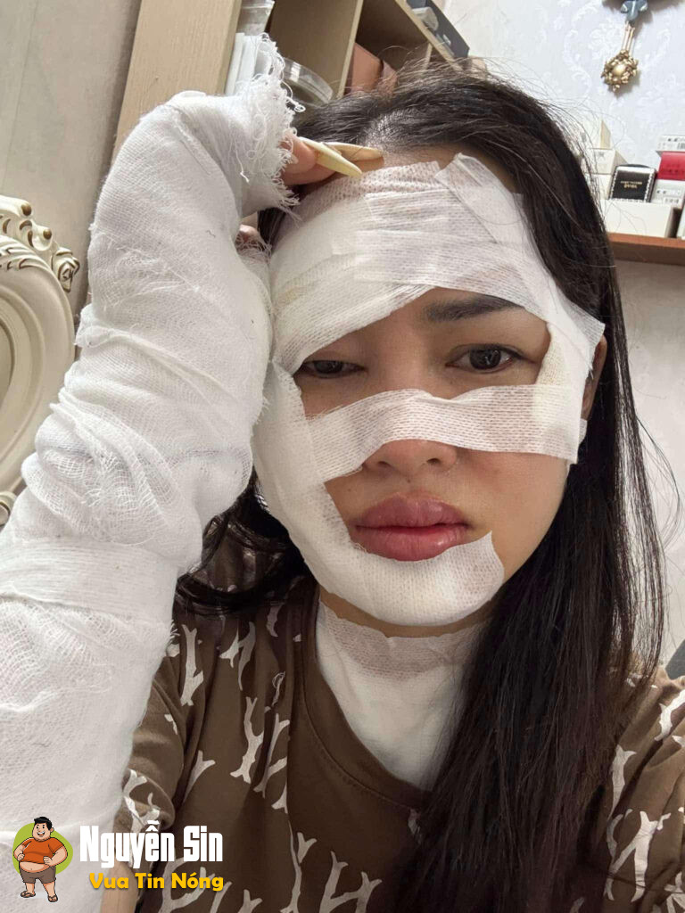 Sinh nhật vui vẻ bỗng chốc thành ác mộng vì bóng bay phát nổ!