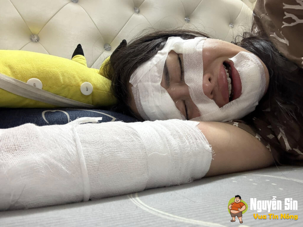 Sinh nhật vui vẻ bỗng chốc thành ác mộng vì bóng bay phát nổ!