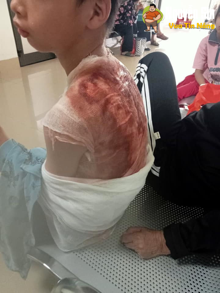 Lập Thạch – Vĩnh Phúc: dì ghẻ, con chồng, nước sôi, 12 tuổi