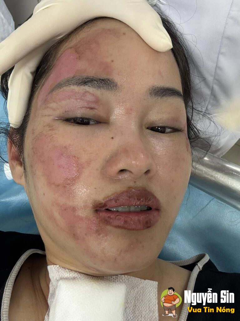 Sinh nhật vui vẻ bỗng chốc thành ác mộng vì bóng bay phát nổ!