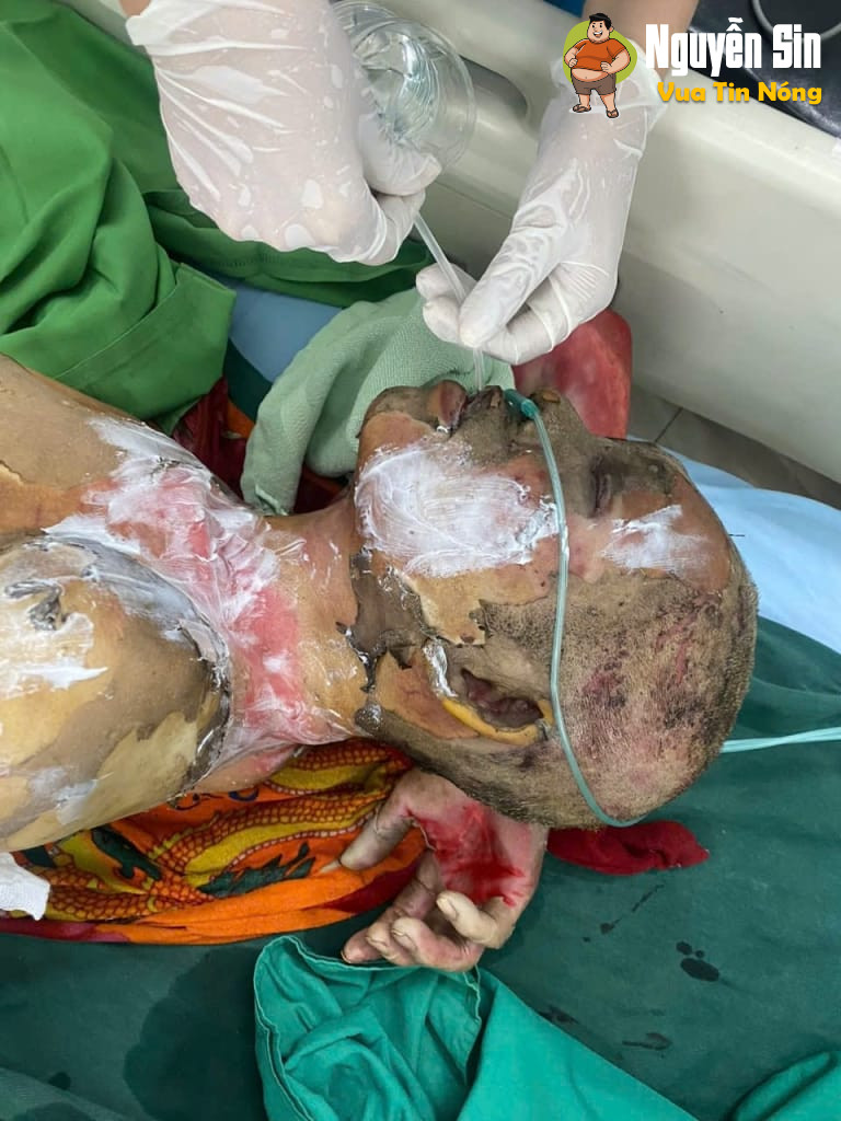 Hà Giang: Con trai tẩm xăng, th/iêu chet bố mẹ đẻ