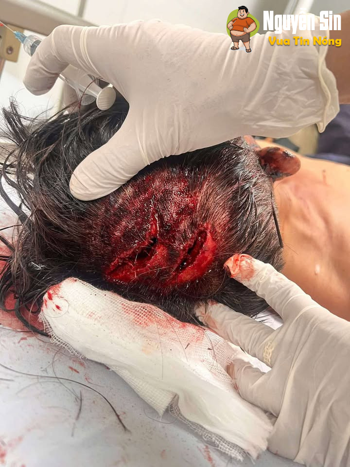 Bình Phước: 1 ng đàn ông bị đ@nh hội đồng khi nhắc nhở nhóm công nhân ăn nhậu hát karaoke