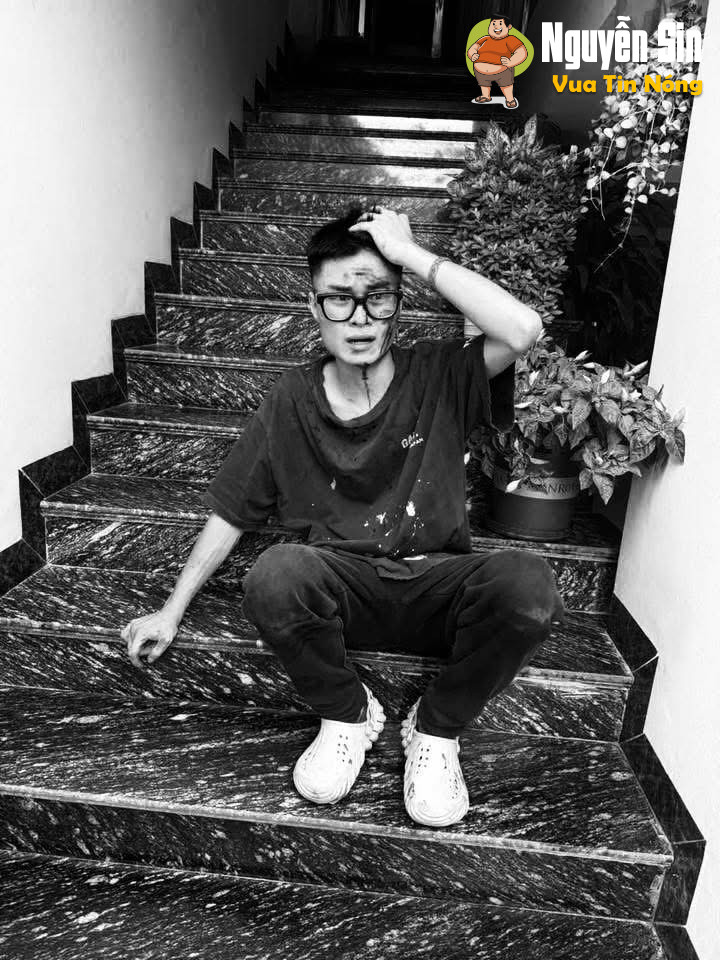 Va chạm giao thông va quệt nhẹ, 2 bố con đi ô tô tác động vật lí nam thanh niên dã man m.á.u be bét.