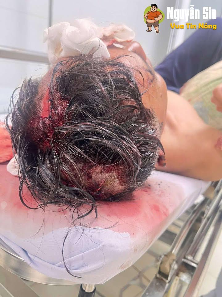 Bình Phước: 1 ng đàn ông bị đ@nh hội đồng khi nhắc nhở nhóm công nhân ăn nhậu hát karaoke