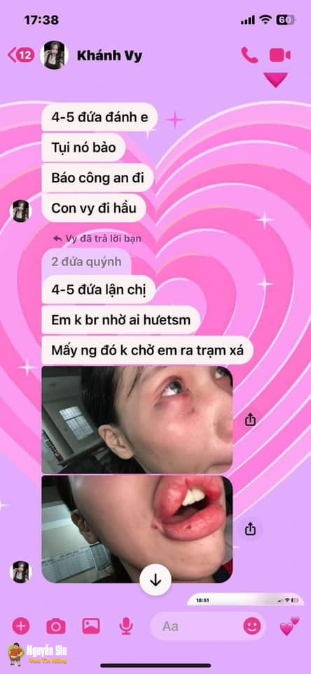 Bà Rịa – Vũng Tàu: Cô gái 17 tuổi bị bạn nhậu và bạn trai đ@nh tvong