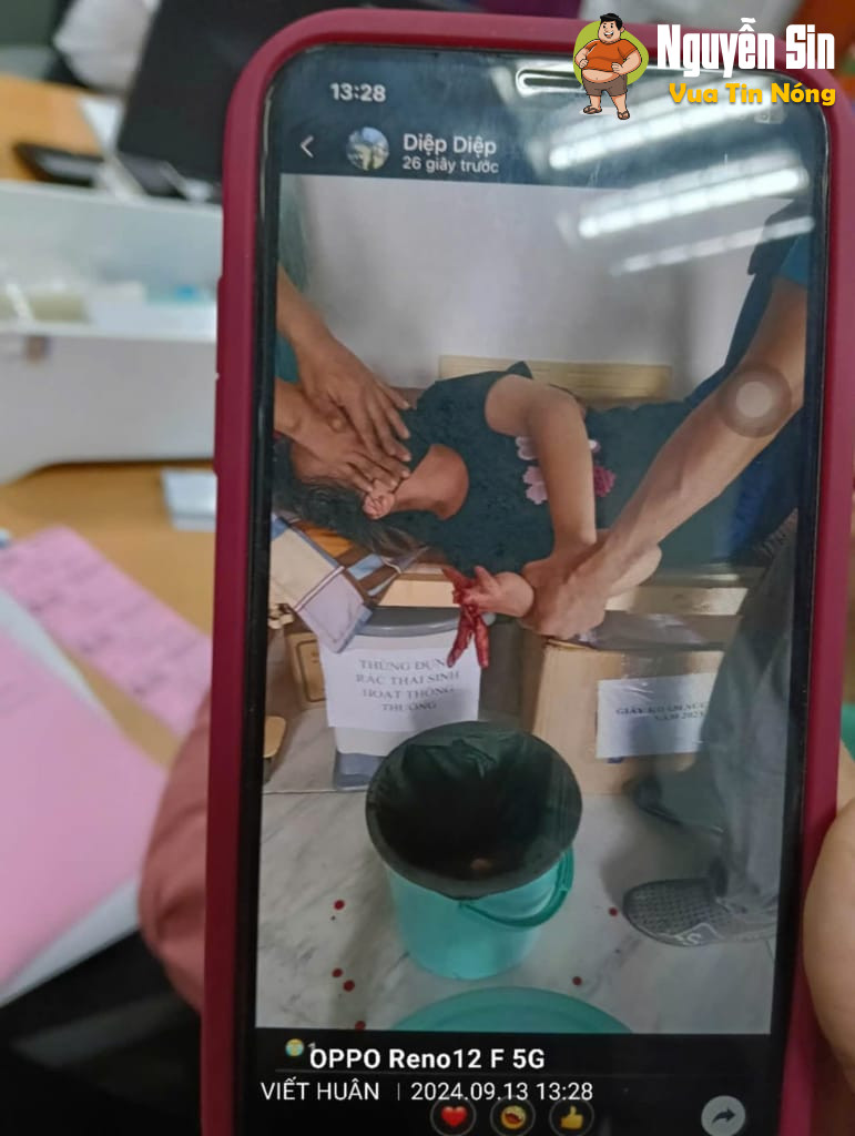 Biên Hoà – Đồng Nai : TNLĐ một công nhân bị cắt đứt các ngón tay phải