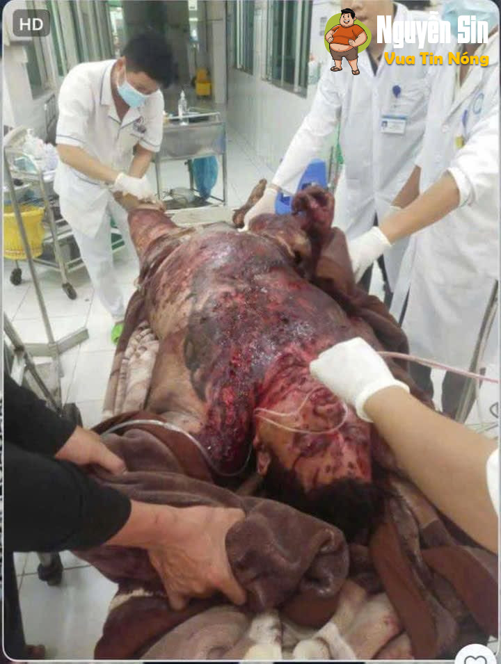 1 người ko qua khỏi sau tiếng nổ ở Thanh Bình, Đồng Tháp