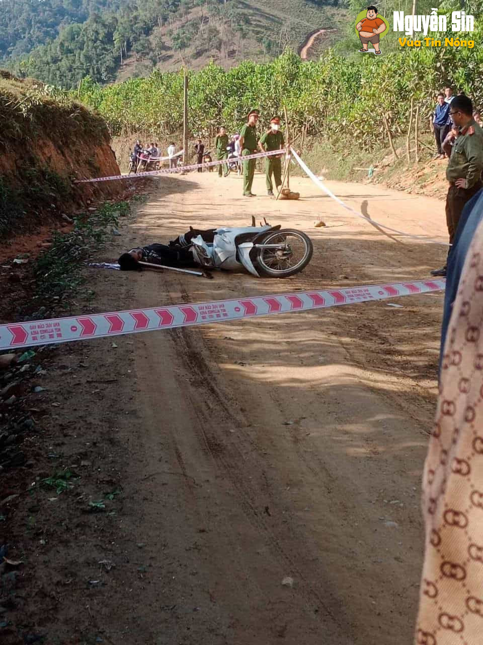 Sơn Lộ, Bảo Lạc – Cao Bằng:1 thanh niên bị thanh sắt cắm vào đầu, chưa rõ nguyên nhân