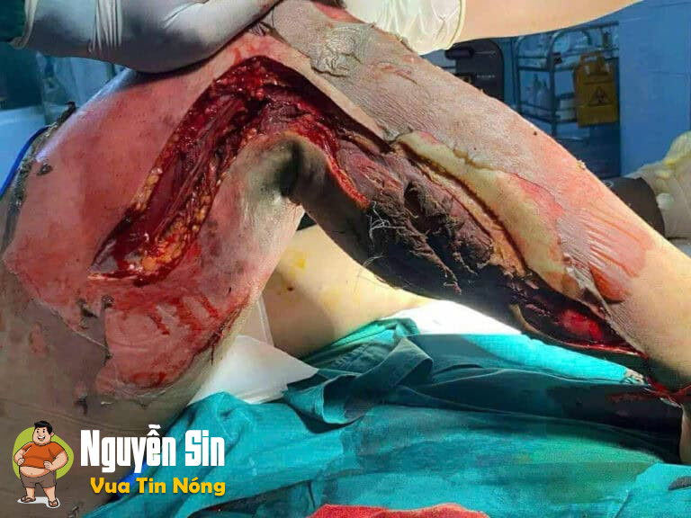 Vĩnh Lộc – Thanh Hoá: 1 ng đàn ông bị đjện giật nguy kịch.