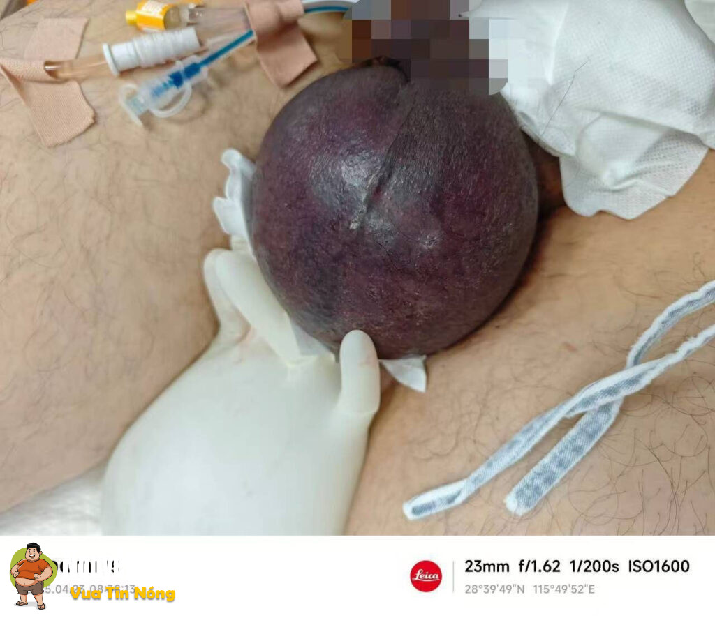 Trung Quốc: Va chạm giao thông khiến bộ phận sinh dục của người đàn ông điều khiển xe máy bị….