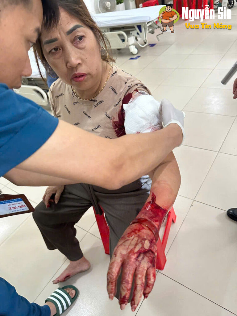 Ngay cổng trường THCS Đông Tiến – Thanh Hóa : 2 bà vác dao che’m nhau cật lực, 1 bà cấp cứu !