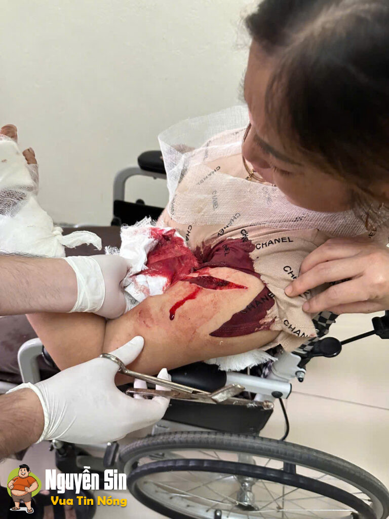 Ngay cổng trường THCS Đông Tiến – Thanh Hóa : 2 bà vác dao che’m nhau cật lực, 1 bà cấp cứu !