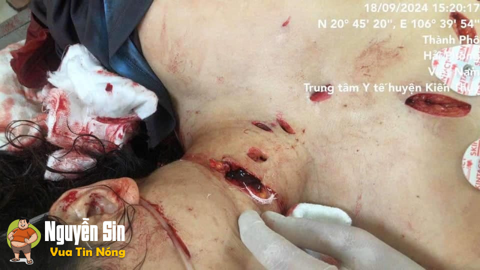 An mạng ở Kiến Thụy – Hải Phòng