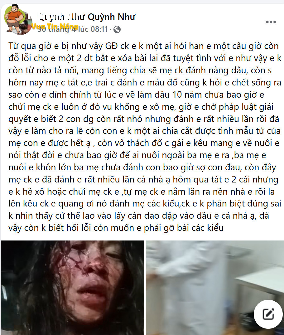 Người phụ nữ lên tiếng tố bị mẹ chồng và em chồng hành hung, chồng không can thiệp mà còn tiếp tay
