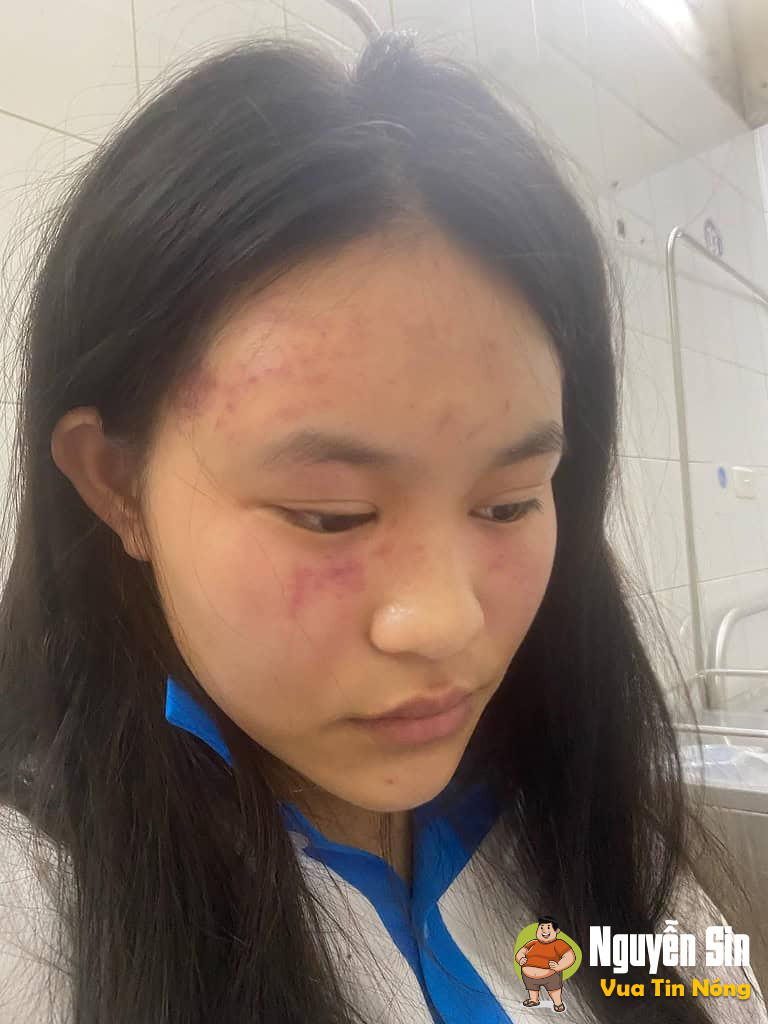 Hải Dương: Bố mẹ ly hôn: Con gái 17 tuổi ở nhà ông bà ngoại…bị cha, chú kéo đến oánh cực kỳ daman khi mẹ đi làm xa