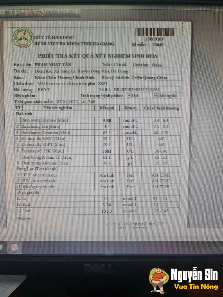 Đồng Văn Hà Giang: mất 1 tay vì phao