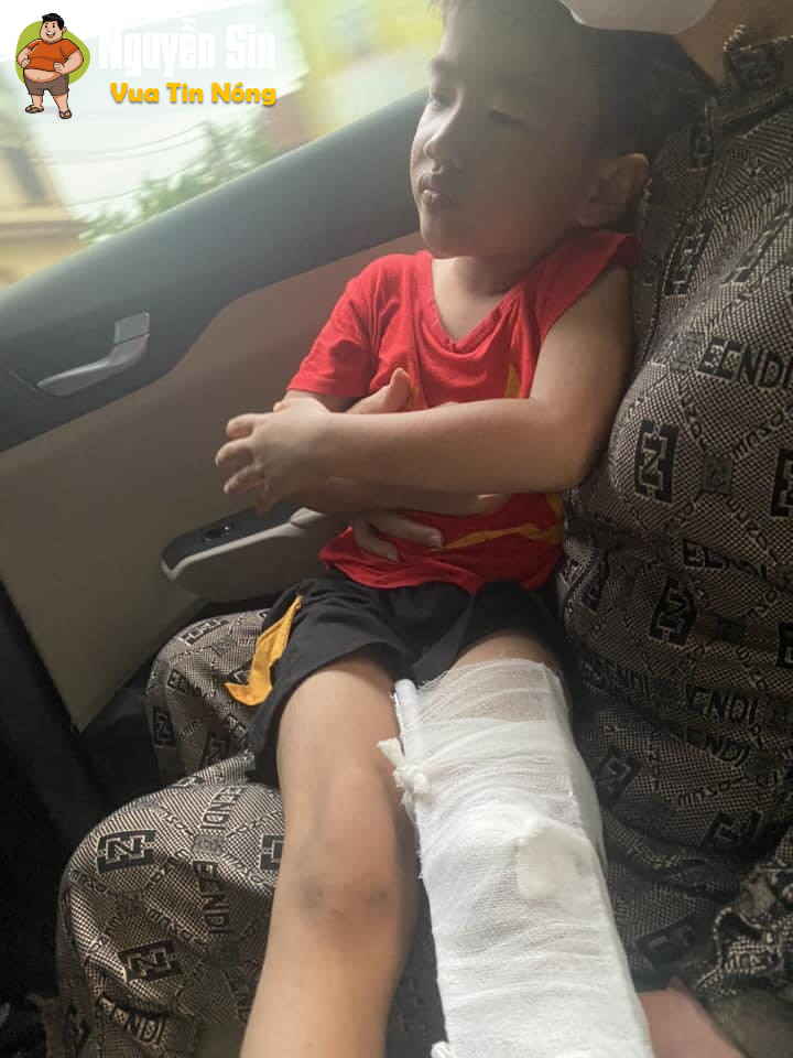 Nhà có con bé gần đường mn trông chừng cẩn thận!