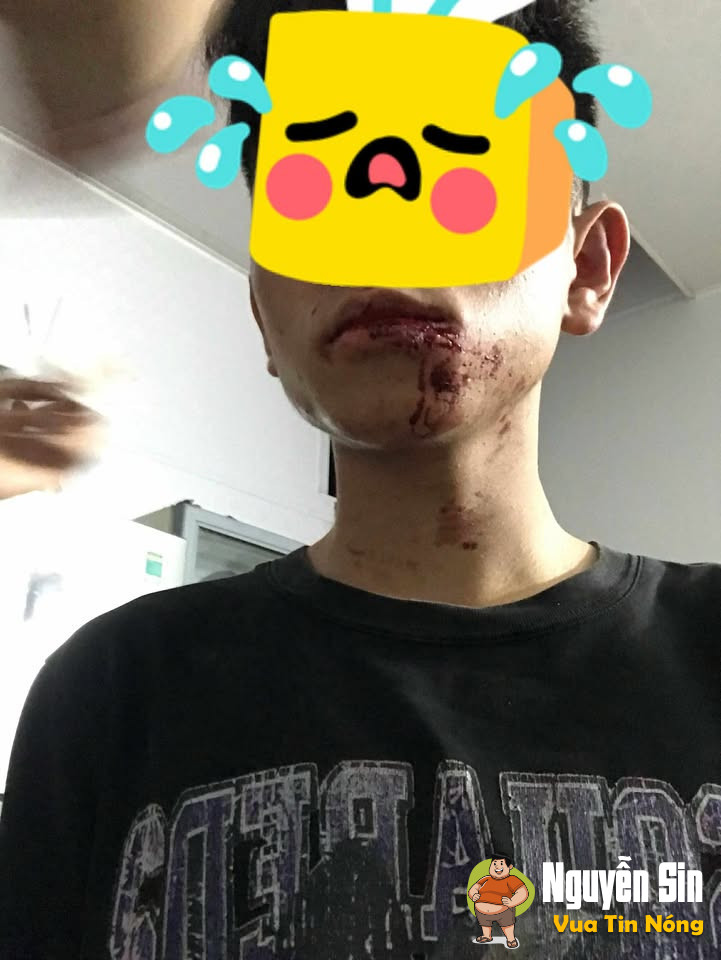 Thanh Miện Hải Dương: nghe 2 bạn lèm bèm cả nửa tiếng, khó chịu nên thanh niên bảo chủ quản mở giúp cái loa cho đỡ ồn thì bị đánh hoidong