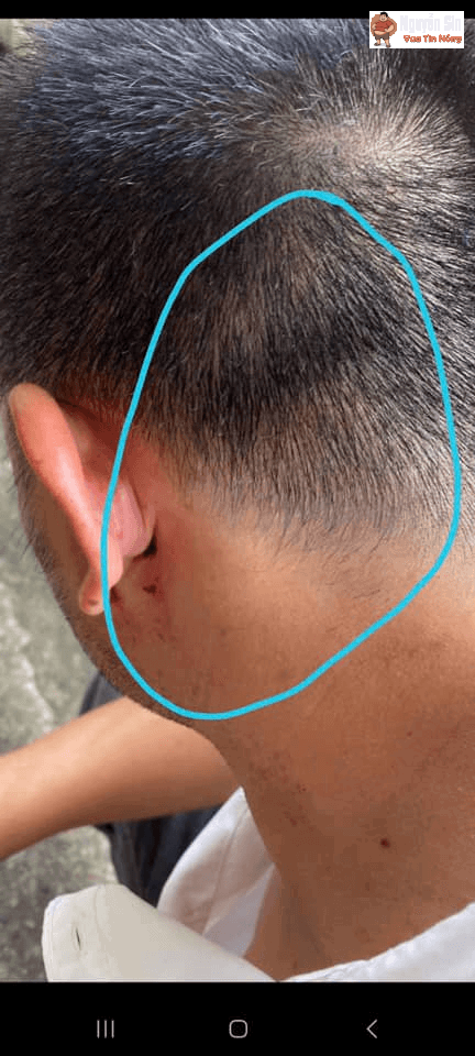 Chưa rõ nguyên nhân gì mà anh tài xế bị 1 số người tác động vật lý rất nhiều