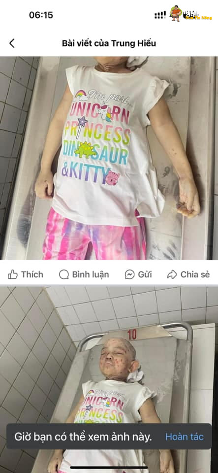 Người ”Mẹ Ruột ” nhẫn tâm h@nh hạ con mình đến chet