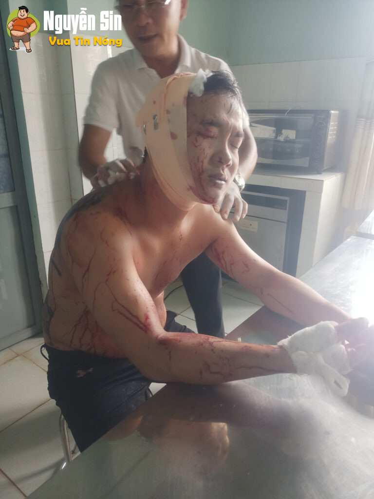Thanh Hoà, Bù Đốp, Bình Phước: Mauthuan họ hàng, ng đàn ông bị chem vao đầu