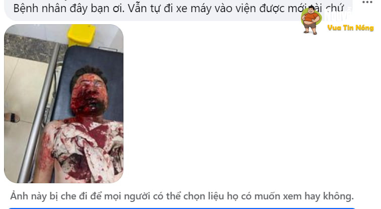 Tuyên Quang: Sau tiếng nổ lớn, 1 người đàn ông nhập viện với phần FACE ID be bét m**