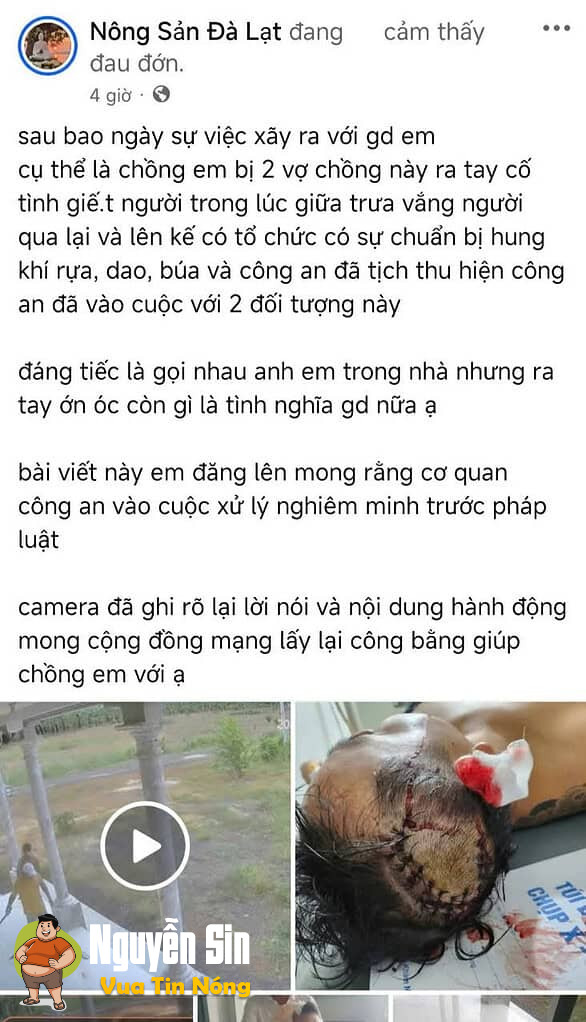 Thanh Hoà, Bù Đốp, Bình Phước: Mauthuan họ hàng, ng đàn ông bị chem vao đầu