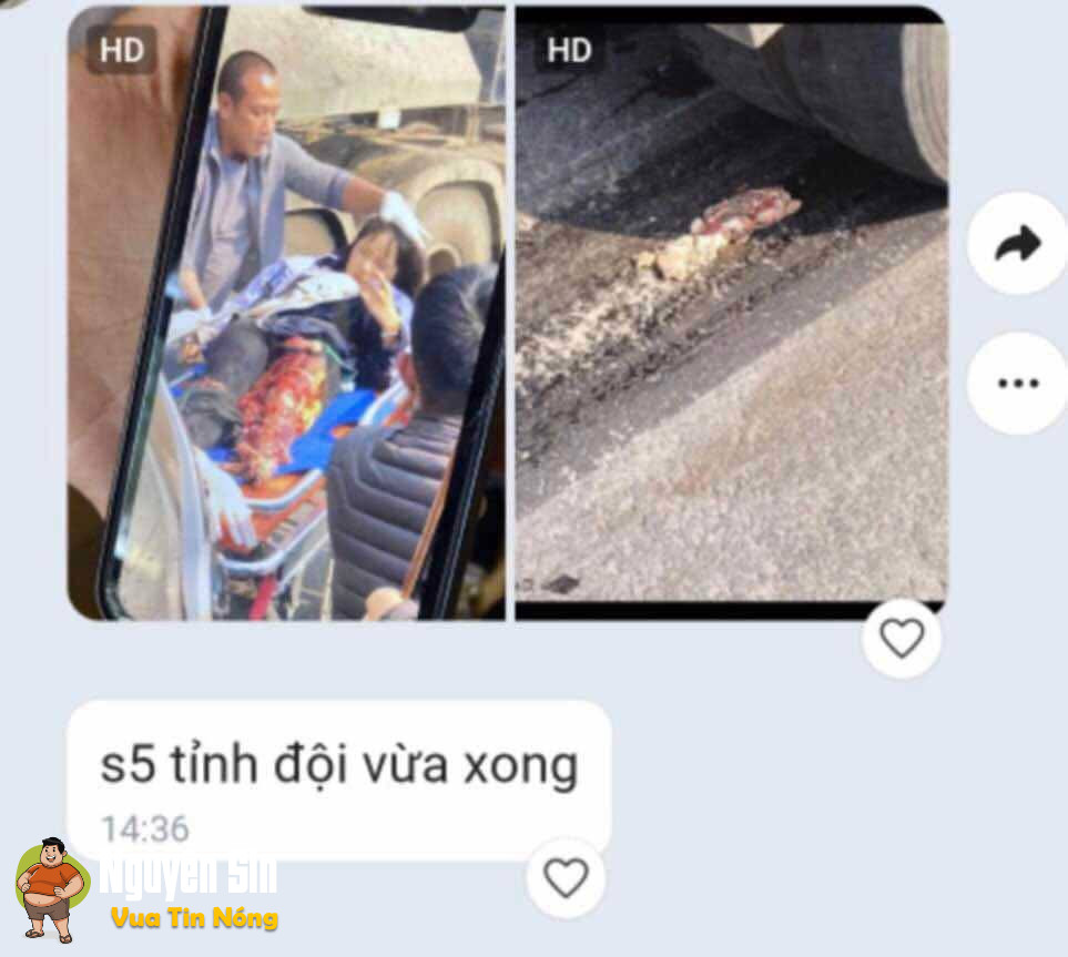 Ỷ La – Tuyên Quang: TNGT khiến 1 bạn nữ chân không còn nguyên vẹn…