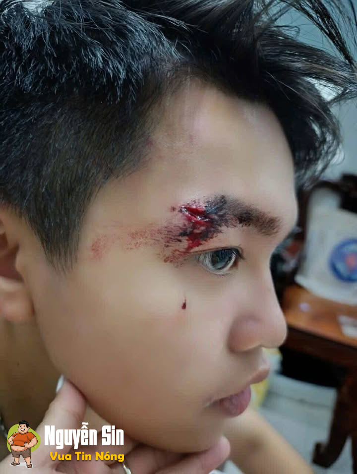 TP.HCM: Gần 10 người hành hung 1 thiếu niên trong khu đô thị Sala