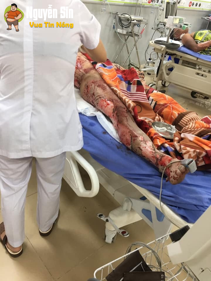 Nổ khí ga ở ngã tư Ốc Vít – Khai Quang – Vĩnh Yên – Vĩnh Phúc