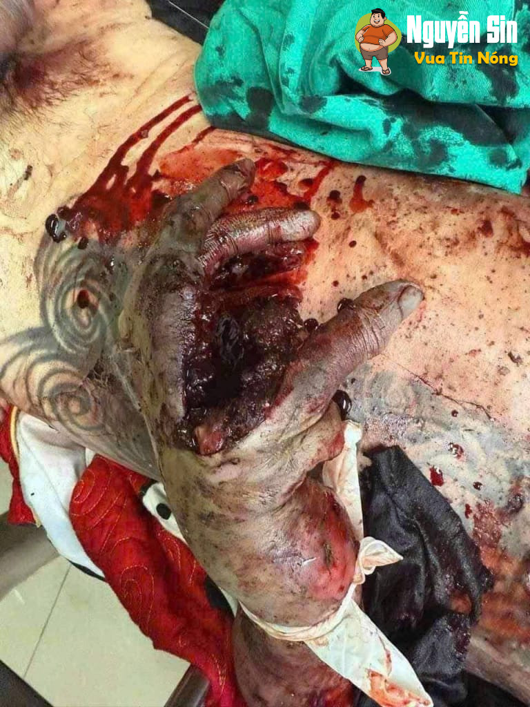 Quang Trung Hà Giang: 1 người được khiêng ra sau tiếng n/ổ lớn