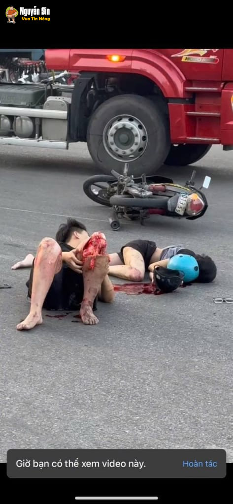 Vòng Xuyến Trà Cổ – Móng Cái – Quảng Ninh: 1 cặp nam nữ đi xe máy varcham với xe tải, bạn nữ đã TV