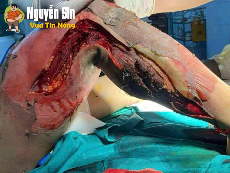 Vĩnh Lộc – Thanh Hóa trưa nay: